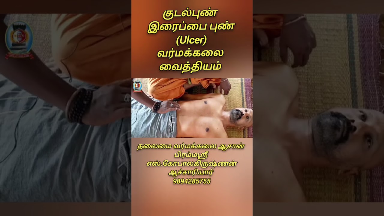 குடல்புண், இரைப்பை புண் (Ulcer) குணமாக வர்மக்கலை வைத்தியம்