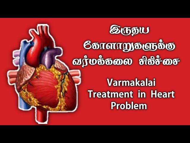 வர்மக்கலை இருதய சிகிச்சை/Varmakalai Heart Treatment/S.Gopalakrishnan+919894285755